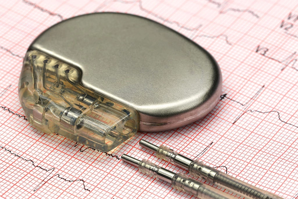 Can You Get An MRI Scan With A Pacemaker?