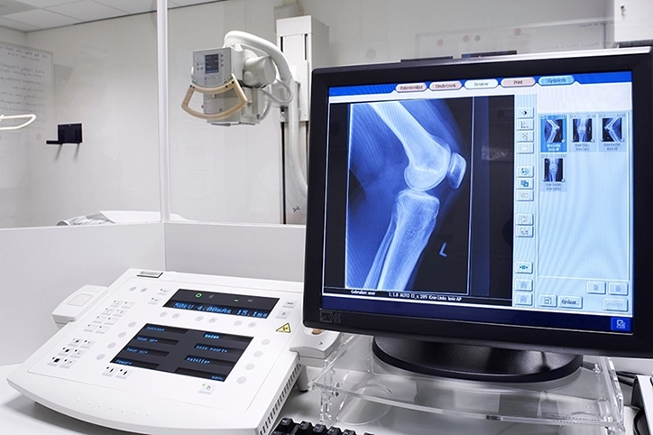 Knee X Ray Displayed On Monitor In Exam Room