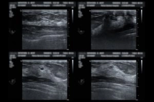 Ultrasound Image Results